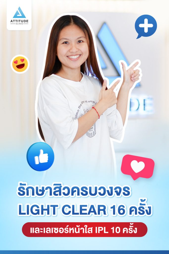 รีวิวรักษาสิวครบวงจร น้องอาย โปรแกรม Light Clear 7 ขั้นตอน จำนวน 16 ครั้ง เลเซอร์หน้าใส Cellec V IPL จำนวน 10 ครั้งที่มีปัญหา สิวอุดตัน สิวอักเสบ สิวแพ้ และรอยสิว