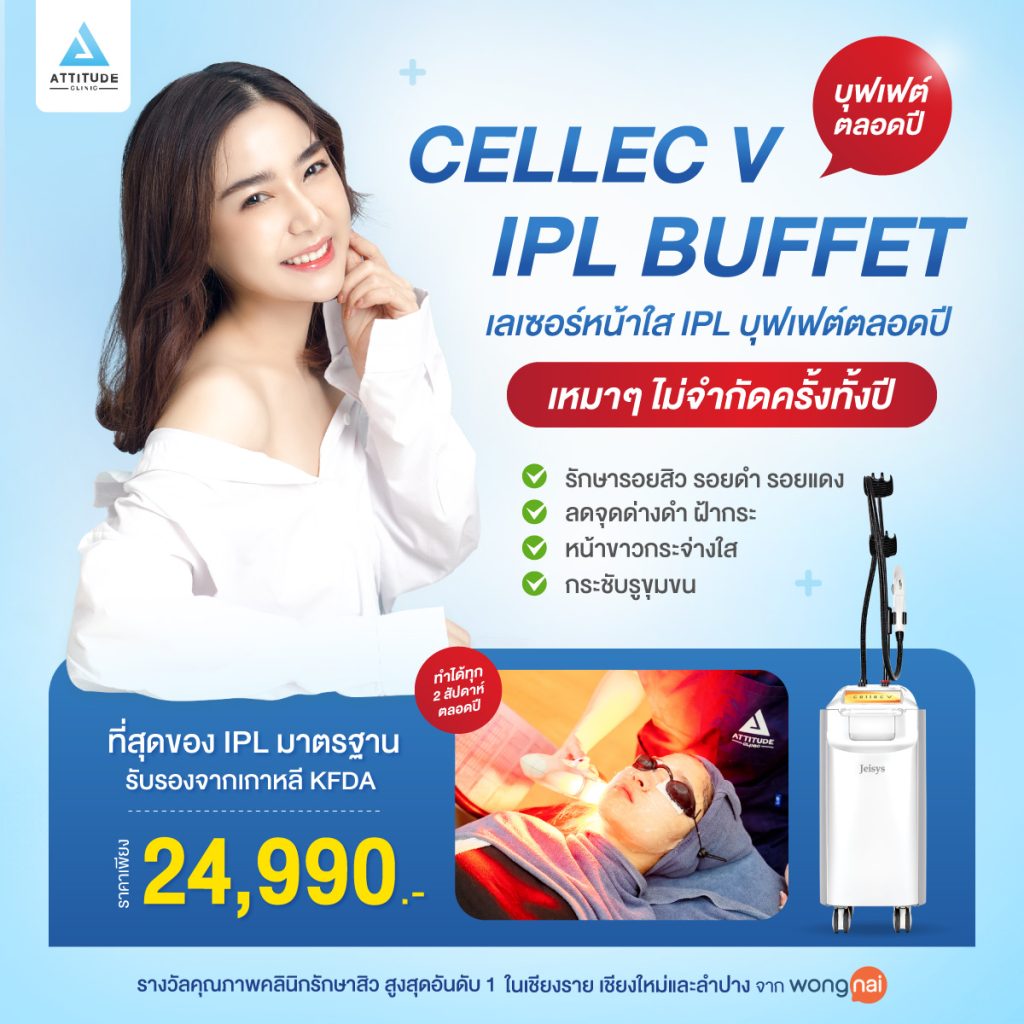 โปรโมชั่นเลเซอร์หน้าใส Cellec V IPL แบบบุฟเฟ่ต์รายปี