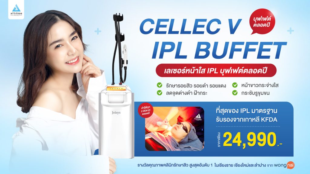 โปรโมชั่นเลเซอร์หน้าใส Cellec V ipl แบบบุฟเฟ่ต์รายปี