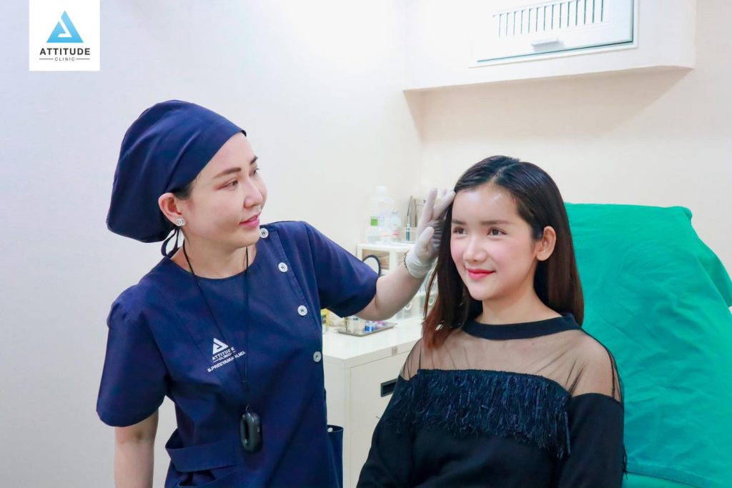 รีวิวเสริมขมับด้วยซิลิโคน จากคุณเปรี้ยว AF2