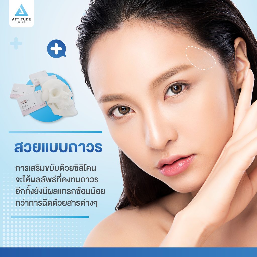 เสริมขมับด้วยซิลิโคนแผ่นแบบถาวร