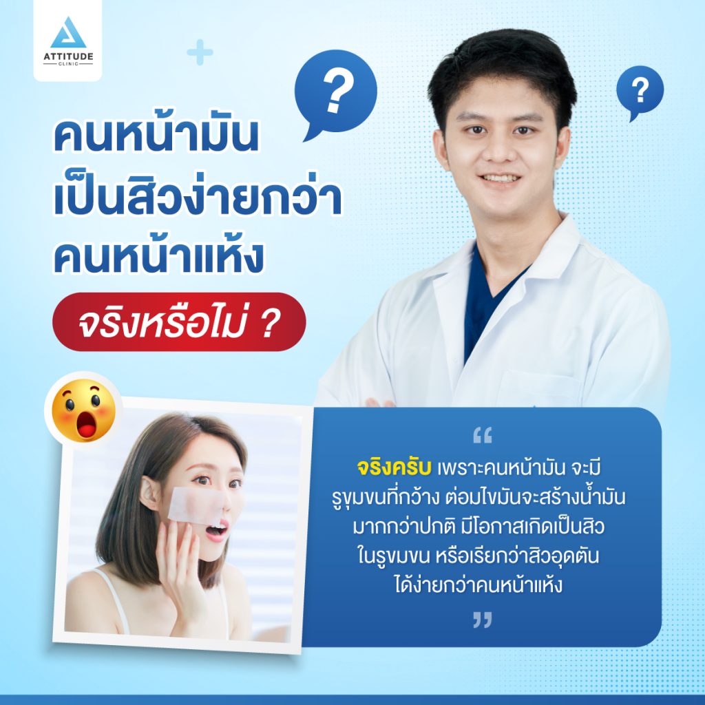 คนหน้ามันเป็นสิวง่ายกว่าคนหน้าแห้ง คนหน้ามันเป็นสิวง่ายกว่าคนหน้าแห้ง จริงหรือไม่?