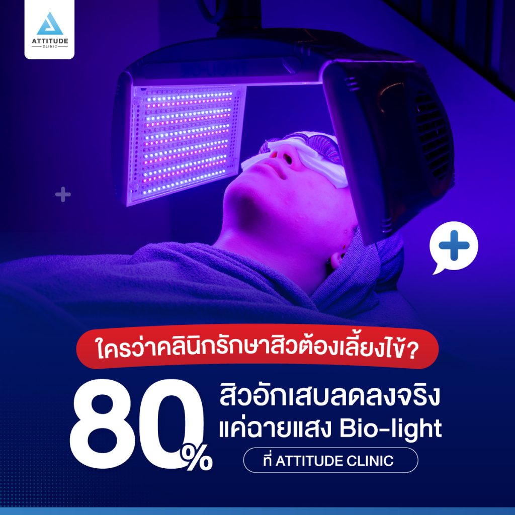 80% สิวอักเสบลดลงจริง ใครว่าคลินิกรักษาสิวต้องเลี้ยงไข้? 80% สิวอักเสบลดลงจริง แค่ฉายแสง Bio-light ที่ Attitude Clinic