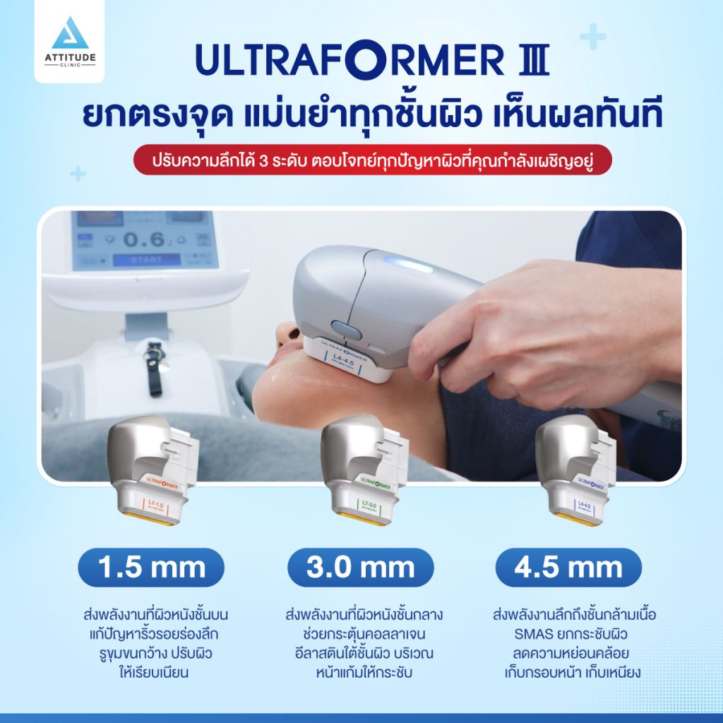 Ultraformer III ยกตรงจุด แม่นยำทุกชั้นผิว เห็นผลทันที