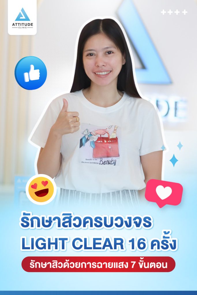 รีวิวรักษาสิวครบวงจร คุณกรกฎ โปรแกรม Light Clear 7 ขั้นตอน จำนวน 16 ครั้ง มีปัญหาสิวและรอยสิวจัดเต็ม หลังรักษาสิวตอนนี้หน้าใสวิ้ง ผิงเรียบเนียน มั่นใจสุดๆ