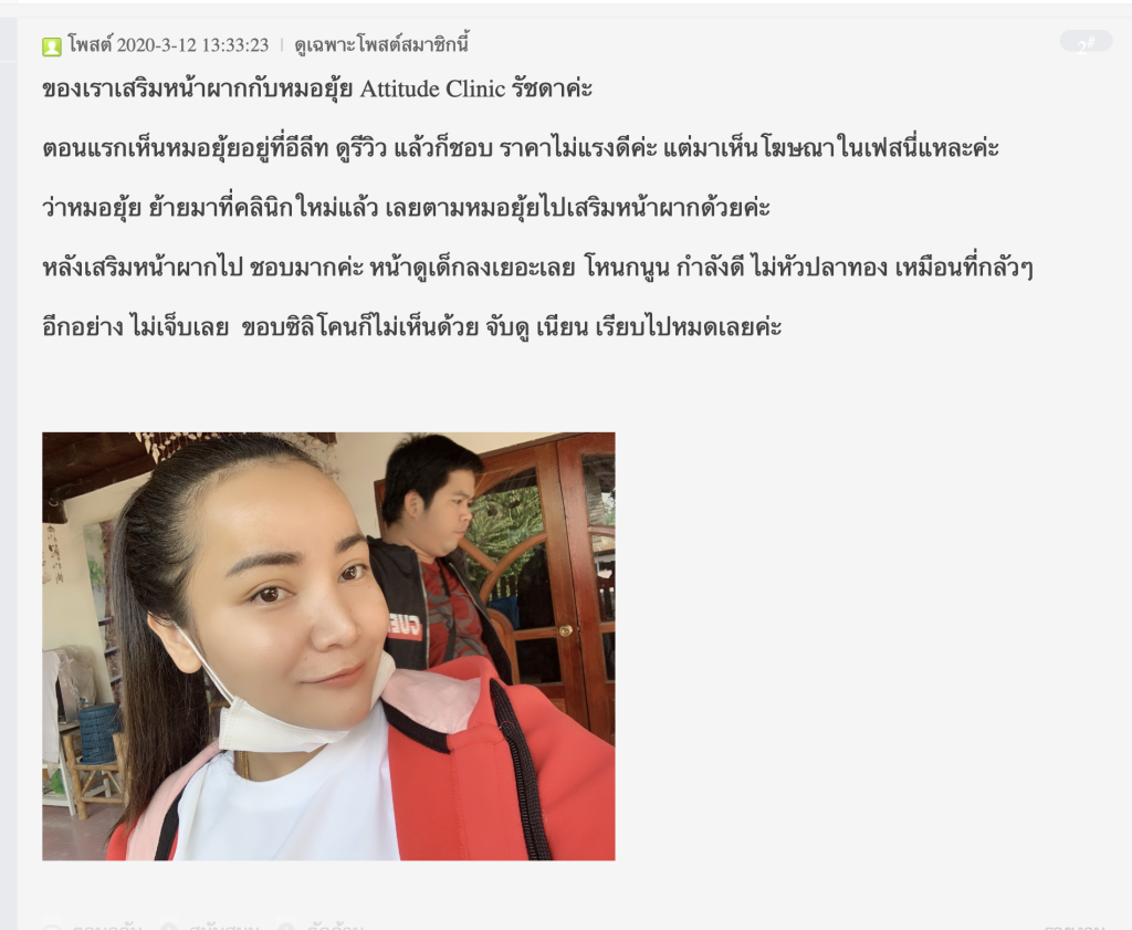 รีวิวเสริมหน้าผากด้วยซิลิโคน