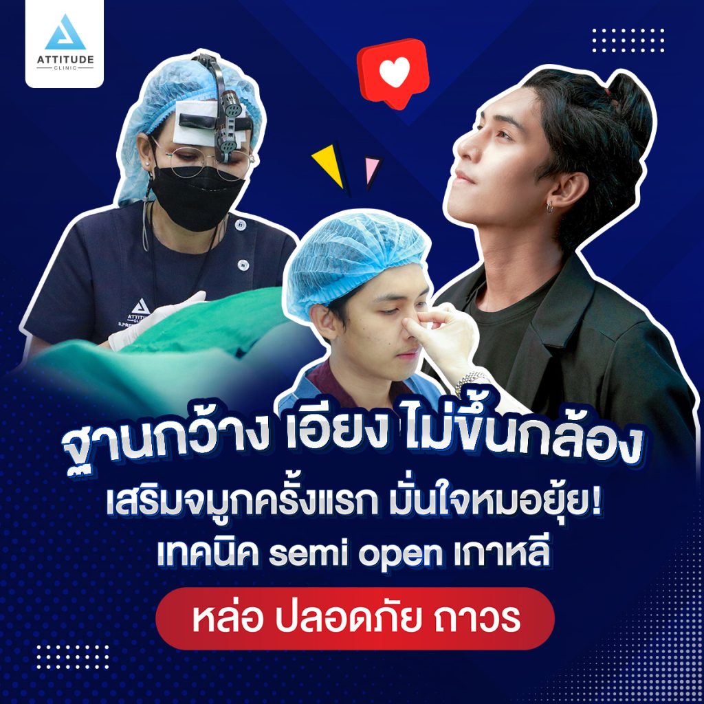รีวิวเสริมจมูกผู้ชาย