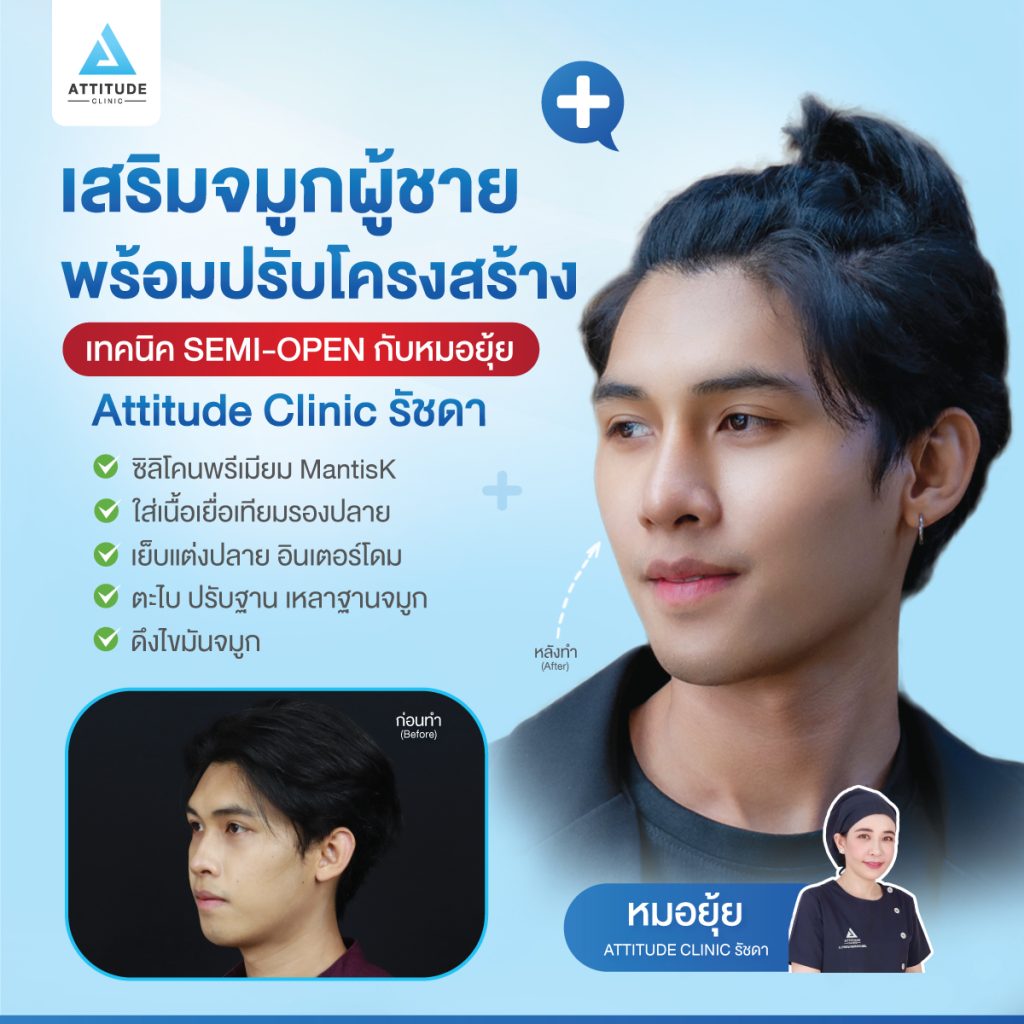 เสริมจมูกพร้อมปรับโครงสร้าง เสริมจมูกพร้อมปรับโครงสร้าง กับหมอยุ้ย Attitude Clinic รัชดา