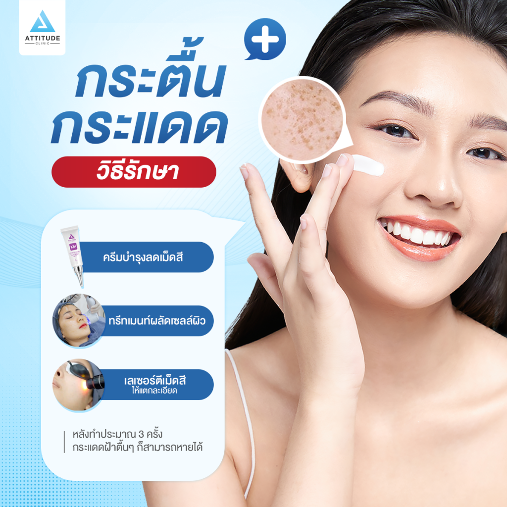 ปัญหาฝ้า กระ รักษาอย่างไรให้หายขาด ?​