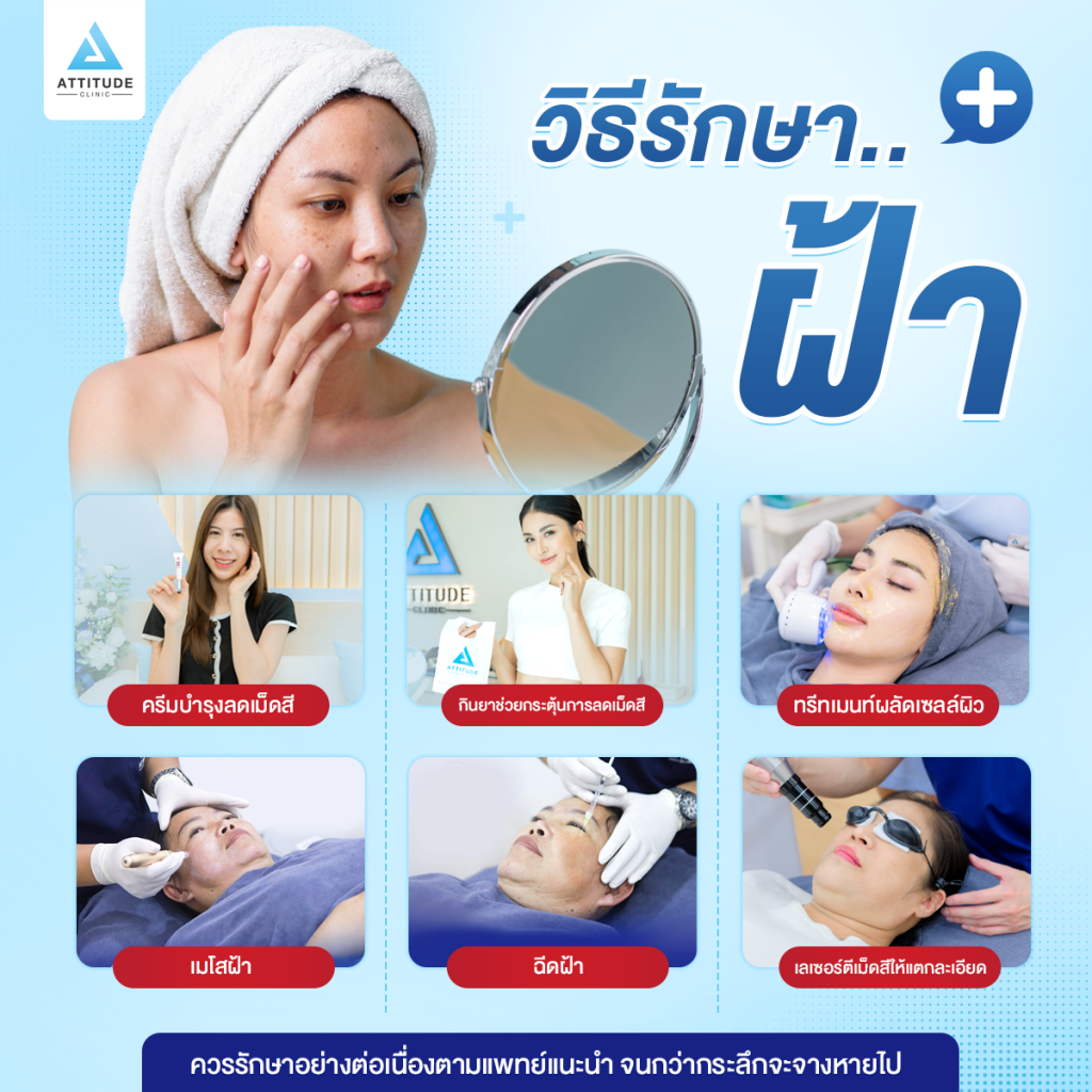ปัญหาฝ้า กระ ปัญหาฝ้า กระ รักษาอย่างไรให้หายขาด ?