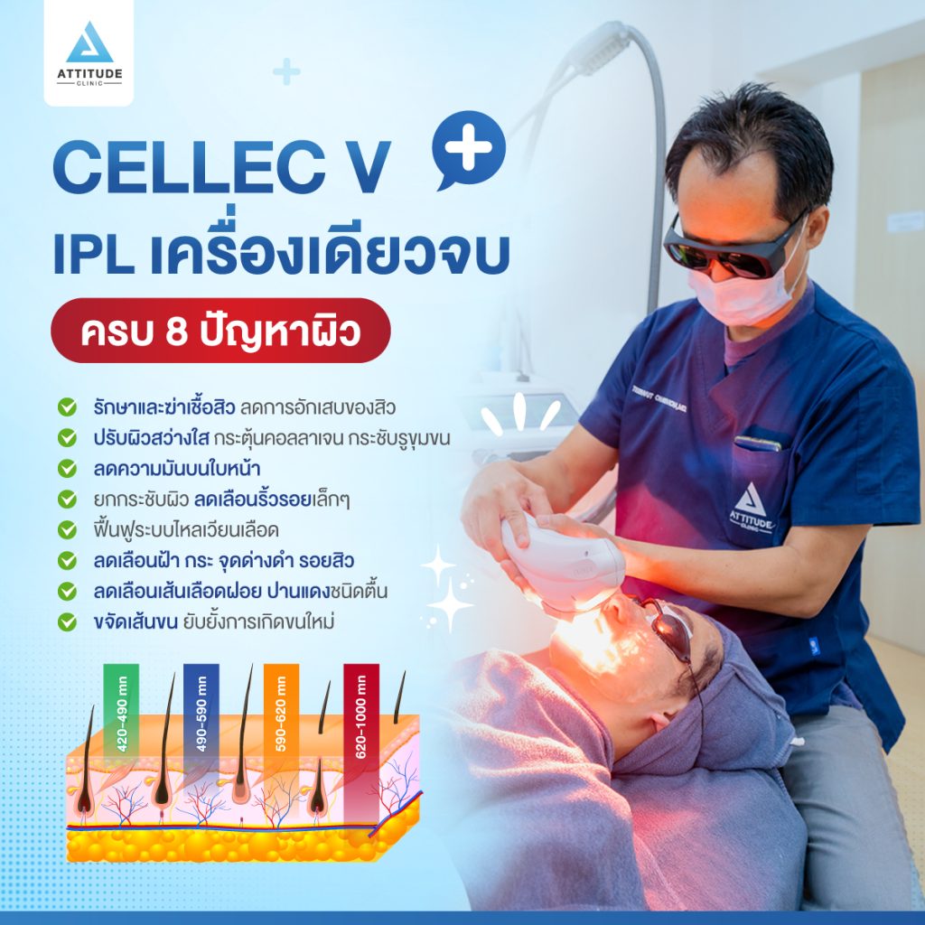 เลเซอร์ Cellec V IPL เลเซอร์ Cellec V IPL เครื่องเดียวจบ ครบ 8 ปัญหาผิว เครื่องแท้จากเกาหลี
