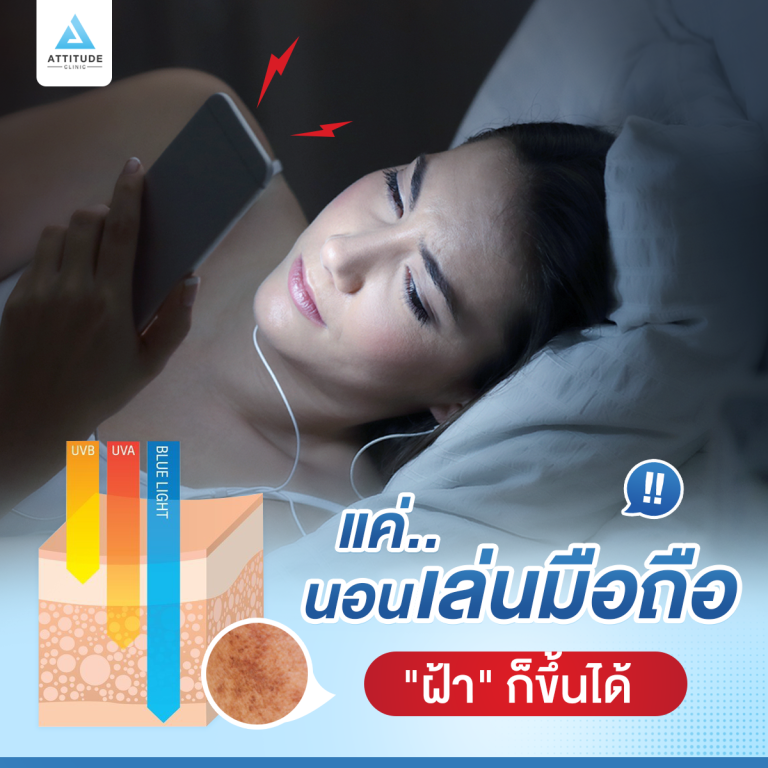 My Image 15