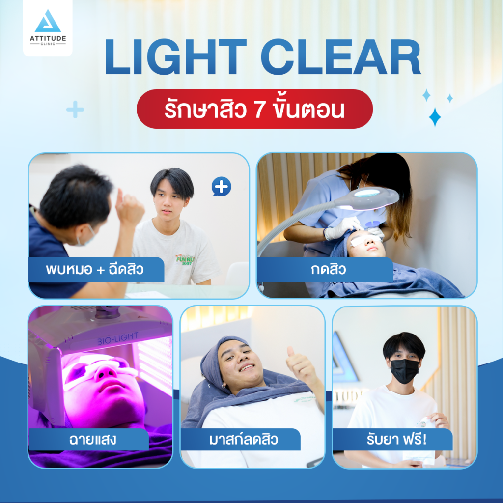 เคยเป็นสิวแต่ตอนนี้หายแล้ว เพราะมี Attitude Clinic เป็นตัวช่วยเรื่องผิวใส