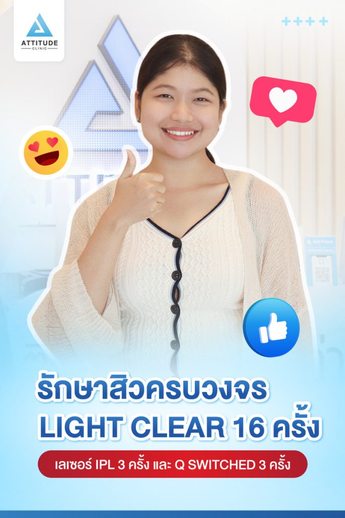 สิวไม่หาย ไม่ให้กลับ! รีวิวรักษาสิวด้วยการฉายแสง Light Clear 7 ขั้นตอน จำนวน 16  ครั้ง เลเซอร์หน้าใสลดรอยสิว IPL จำนวน 3 ครั้ง และเลเซอร์ลดจุดด่างดำ Q-Switched จำนวน 3 ครั้ง ของน้องแป้ง