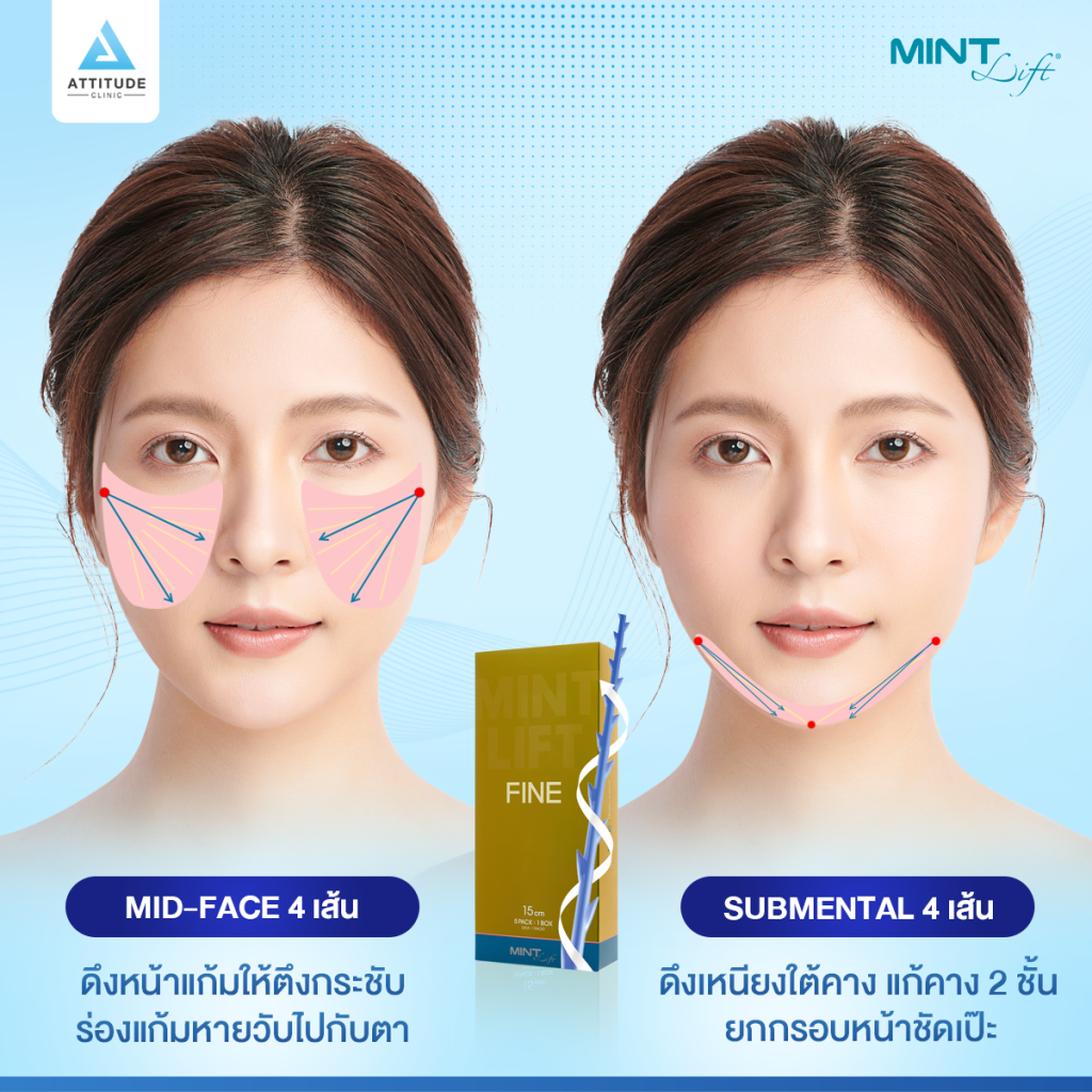 สวยย้อนวัยร้อยไหม MINT Lift แก้ปัญหาจุดไหนได้บ้าง ?