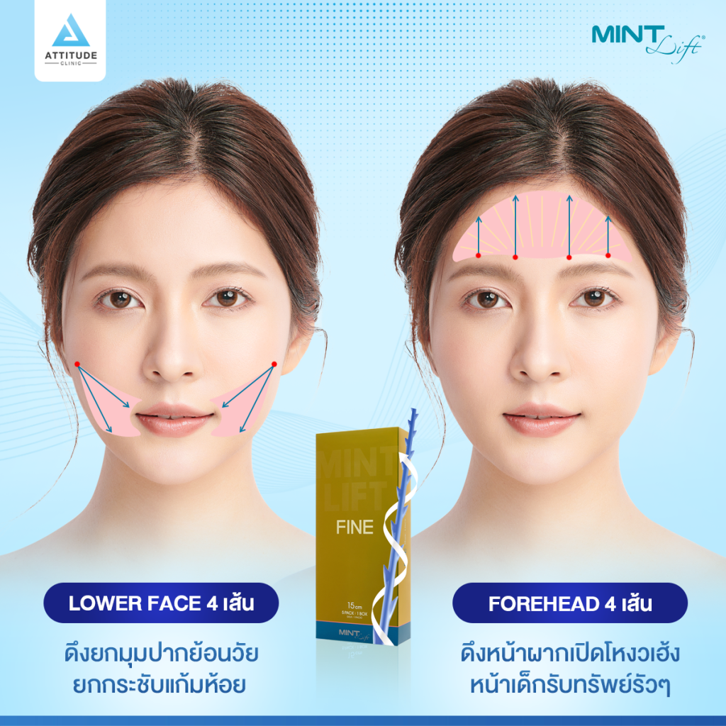 สวยย้อนวัยร้อยไหม MINT Lift แก้ปัญหาจุดไหนได้บ้าง ?