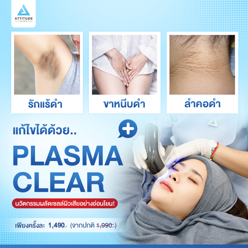 รักแร้ดำ ขาหนีบดำ คอดำ แก้ได้ด้วย Plasma Clear นวัตกรรมผลัดเซลล์ผิวเสียอย่างอ่อนโยน!