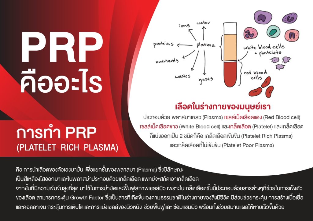 PRP คืออะไร