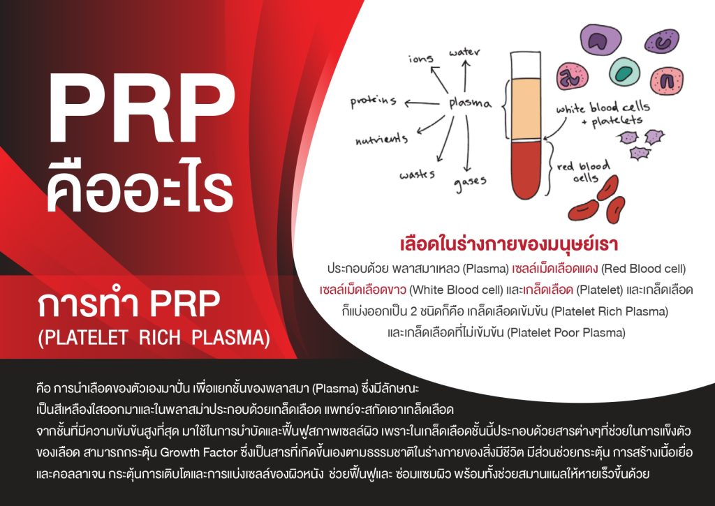 PRP คืออะไร? PRP คืออะไร