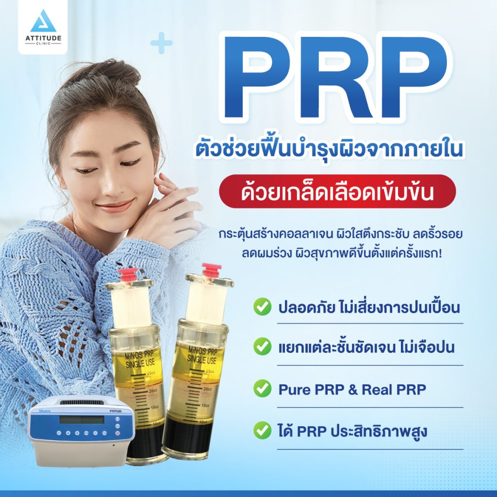 ทำความรู้จัก PRP ทำความรู้จัก PRP ตัวช่วยฟื้นบำรุงผิวจากภายในด้วยเกล็ดเลือดเข้มข้นกระตุ้นสร้างคอลลาเจน ให้ผิวตึงกระชับ และสุขภาพดีขึ้นตั้งแต่ครั้งแรก PRP (PLATELET RICH PLASMA) ดีอย่างไร ? ช่วยอะไรบ้าง?