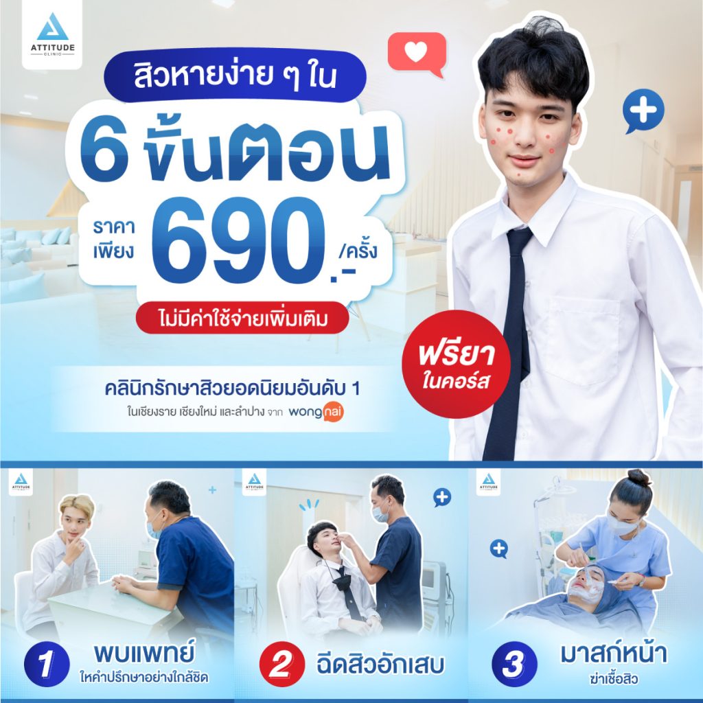 สิวหายง่ายๆใน 6 ขั้นตอน สิวหายจริง! ผิวใสจริง! รักษาสิวกับคลินิกนักษาสิวอันดับ 1 การันตีคุณภาพจาก Wongnai เชียงราย เชียงใหม่ ลำปาง ยืนยันจากผู้รักษาสิว หายจริงแล้วกว่า 20,000 คน