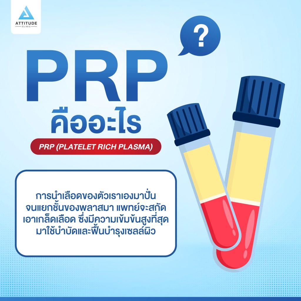 Prp คืออะไร
