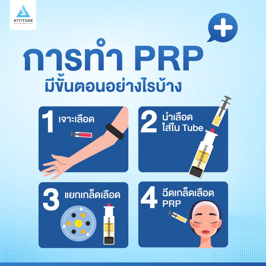 ขั้นตอนการทำ PRP