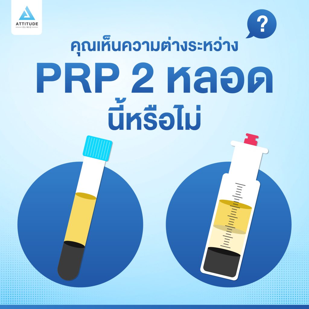 PRP 2 หลอด