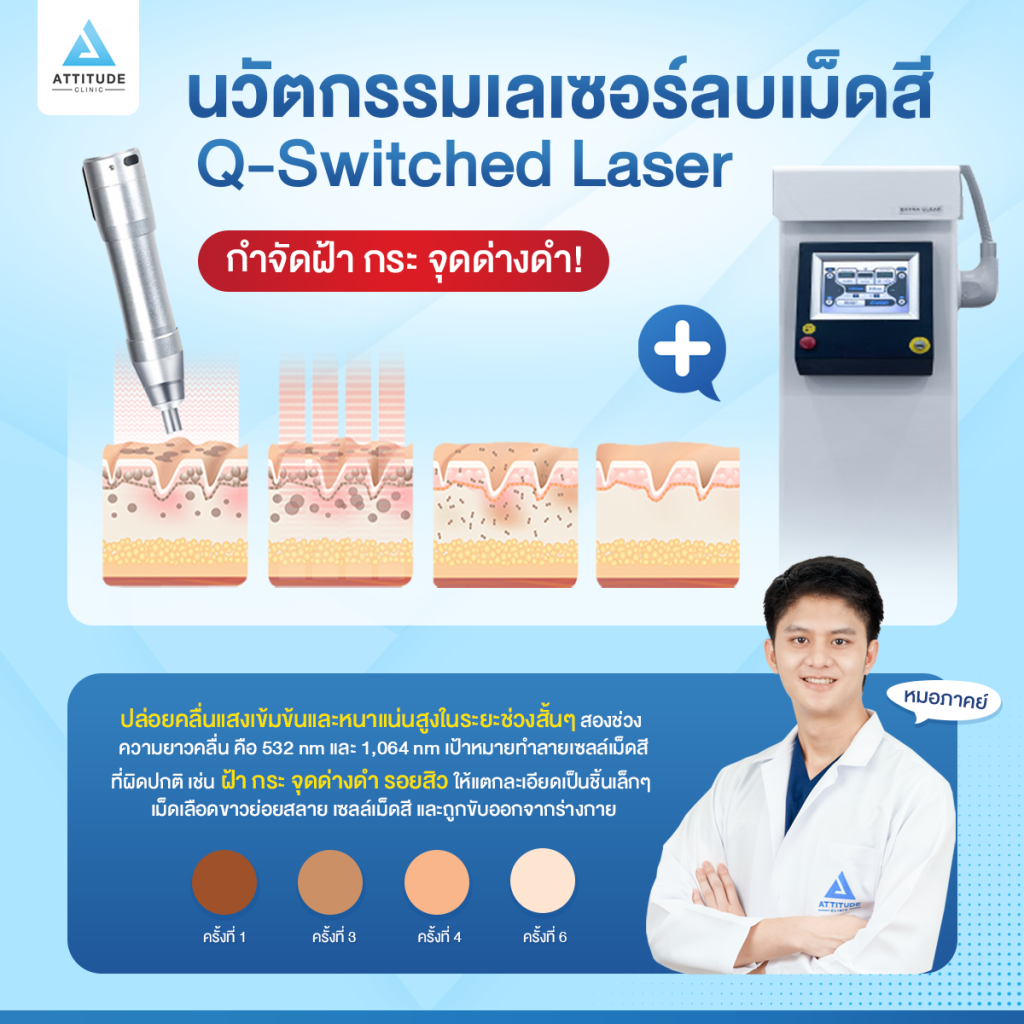 Q-Switched Laser นวัตกรรมเลเซอร์ลบเม็ดสี กำจัดฝ้า กระ จุดด่างดำ ปรับผิวใสวิ้ง กระชับรูขุมขนสุด