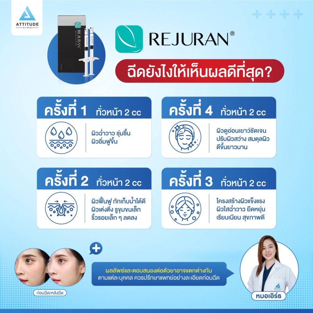 รีจูรัน