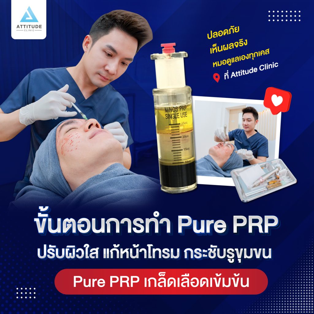 ขั้นตอนการทำ PRP