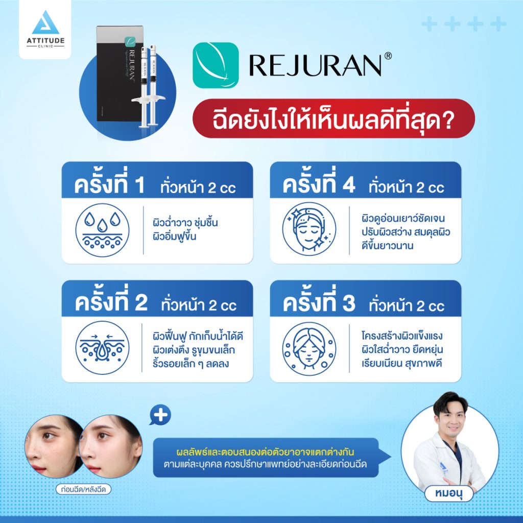 บอกหมดเปลือก! REJURAN ผิวใส ฉ่ำวาวเกาหลี REJURAN ฉีดกี่ครั้ง? REJURAN ฉีดยังไงให้เห็นผลดีที่สุด?