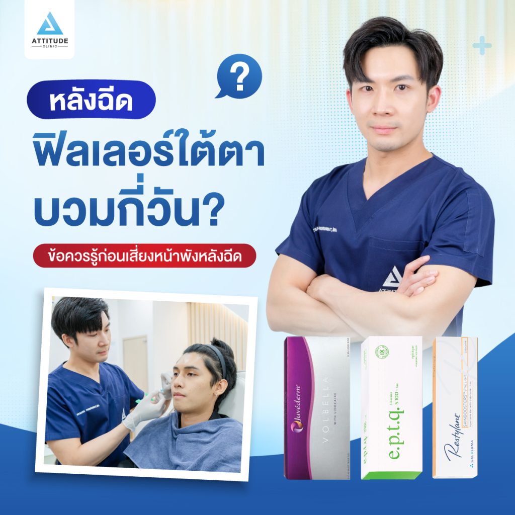 หลังฉีดฟิลเลอร์ใต้ตาบวมกี่วัน ? ข้อควรรู้ก่อนเสี่ยงหน้าพังหลังฉีด