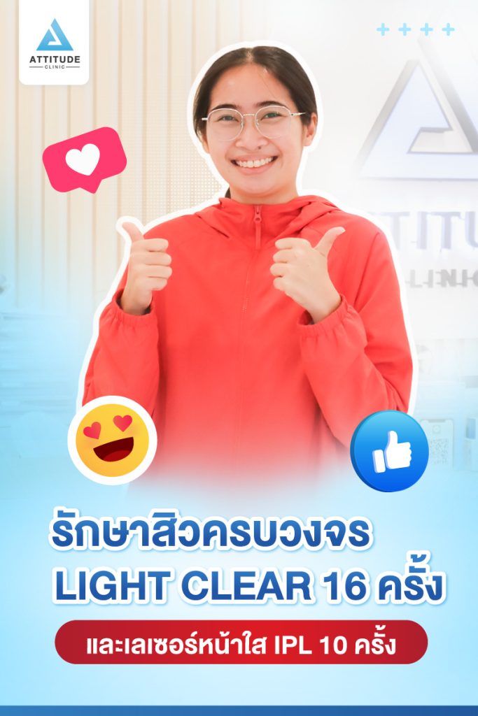 รีวิวรักษาสิว ด้วยการฉายแสง Light Clear 7 ขั้นตอน จำนวน 16 ครั้ง เลเซอร์หน้าใส Cellec V IPL จำนวน 10 ครั้ง ของคุณกิ๊ก ที่มีปัญหาสิวและรอยสิวจัดเต็ม หลังรักษาตอนนี้หน้าใส ไร้สิว มั่นใจขึ้นสุดๆ