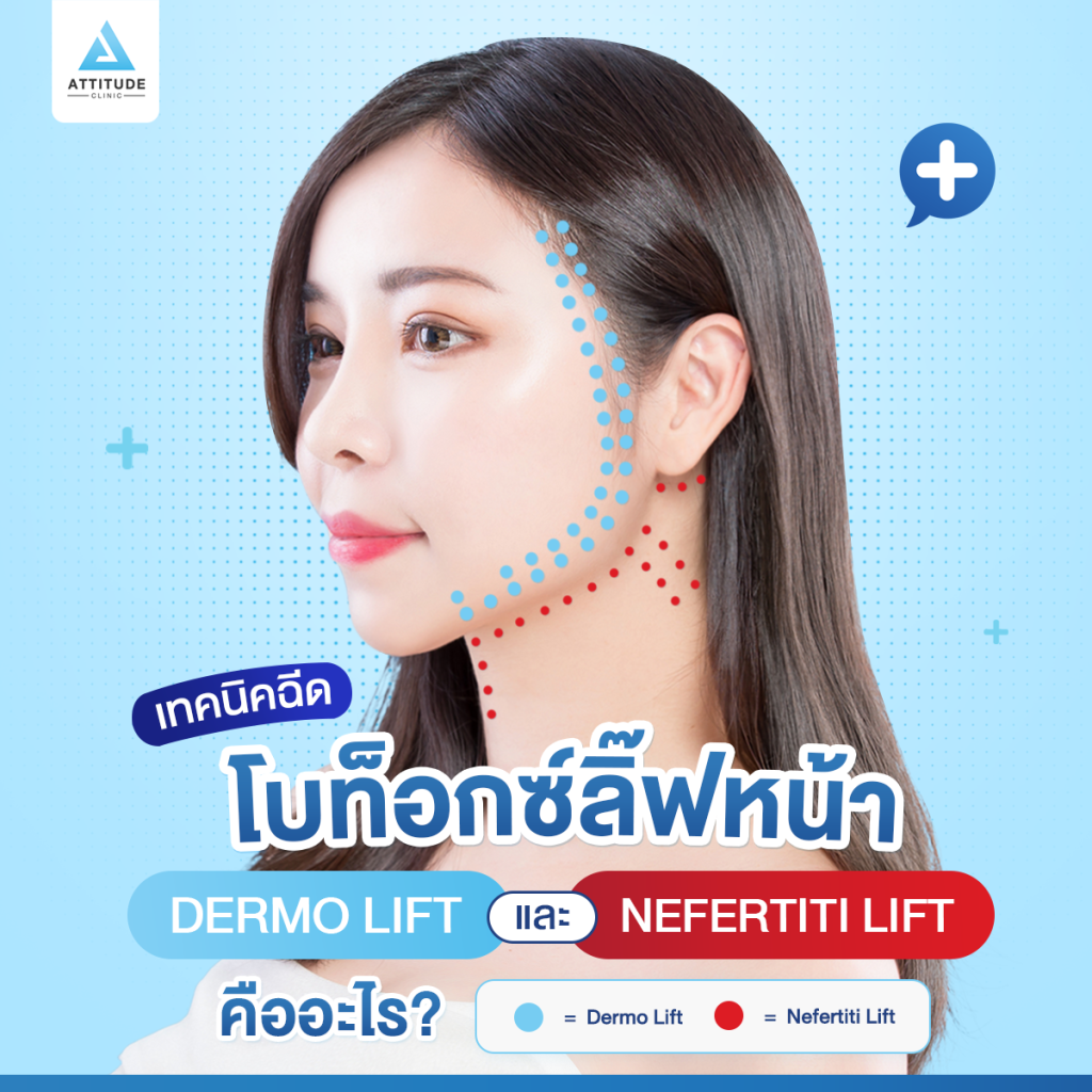 เทคนิคฉีดโบท็อกซ์ลิ๊ฟหน้า เทคนิคฉีดโบท็อกซ์ลิ๊ฟหน้า ยกกระชับ ปรับหน้าเรียวด้วย Dermo Lift และ Nefertiti Lift คืออะไร? เหมือนกันมั้ย? ต้องฉีดแบบไหน?