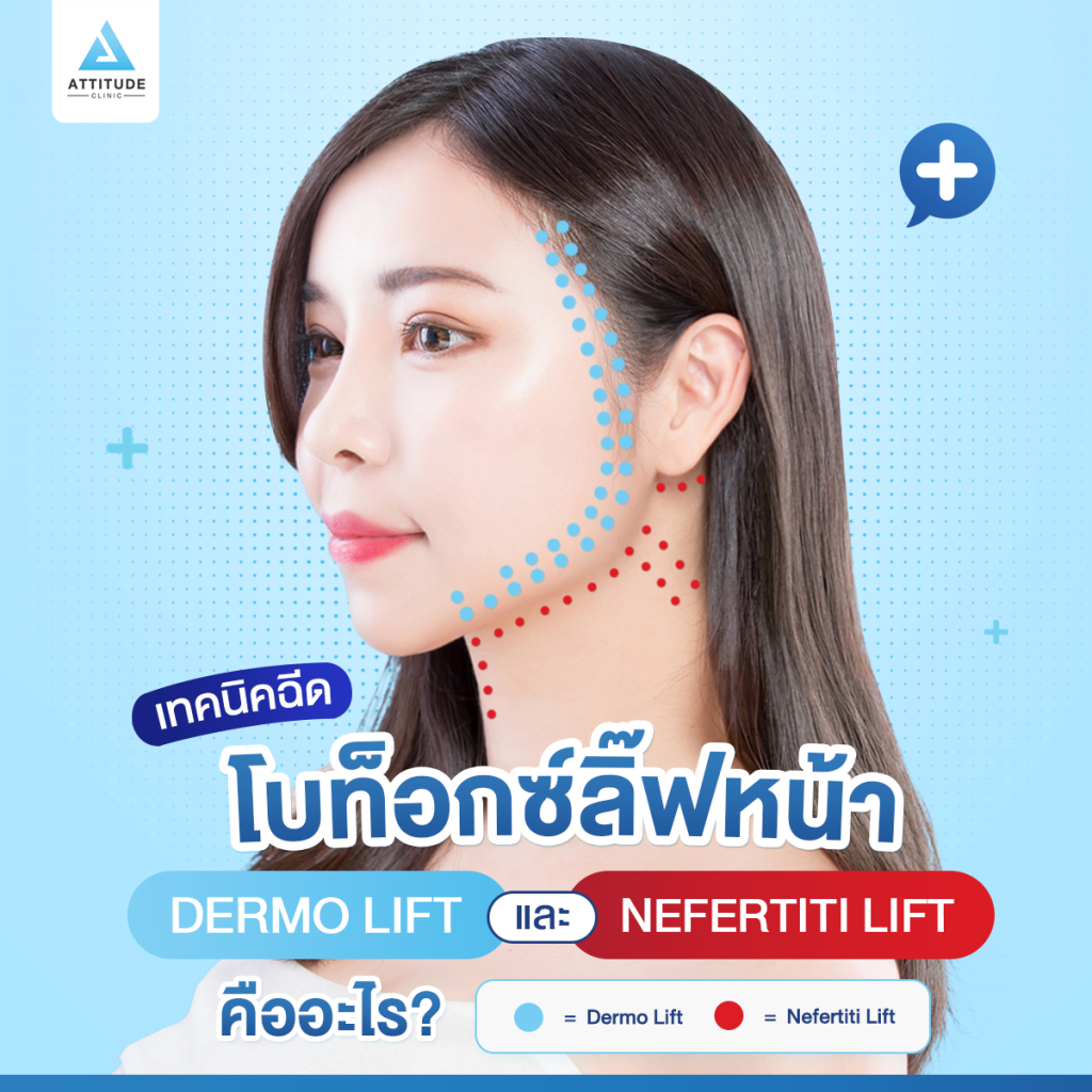 เทคนิคฉีดโบท็อกซ์ลิ๊ฟหน้า ยกกระชับ ปรับหน้าเรียวด้วย Dermo Lift และ Nefertiti Lift คืออะไร?​ เหมือนกันมั้ย? ต้องฉีดแบบไหน?