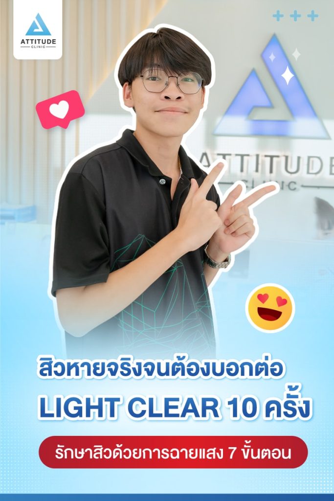 รีวิวรักษาสิว ด้วยการฉายแสงสีฟ้า โปรแกรม Light Clear 7 ขั้นตอน จำนวน 10 ครั้ง ของน้องเก็ท มีปัญหาสิว รอยสิวจัดเต็ม หลังรักษาตอนนี้หน้าใสมั่นใจขึ้นสุดๆ