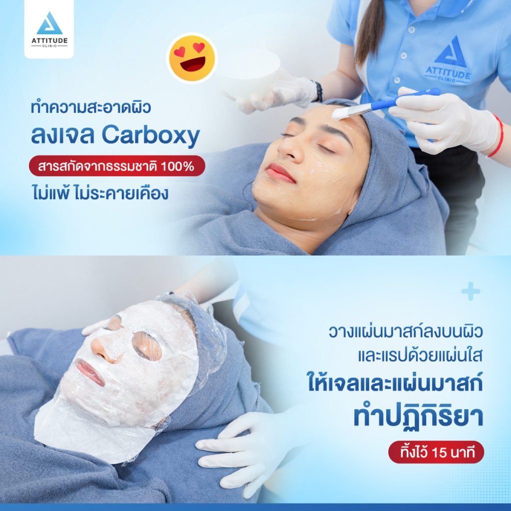 พาดูขั้นตอนการทำ Carboxy Mask มาสก์นวัตกรรมใหม่! เติมออกซิเจนได้อย่างไร? ผิวดีจริงหรือไม่?