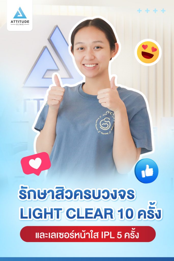 รีวิวรักษาสิวคุณนิรชา ด้วยการฉายแสงโปรแกรม Light Clear 7 ขั้นตอน จำนวน 16 ครั้ง เลเซอร์หน้าใส IPL 5 ครั้ง มีปัญหาสิว รอยสิว ผิวไม่สม่ำเสมอ หลังรักษาตอนนี้หน้าใสขึ้น มั่นใจสุดๆ