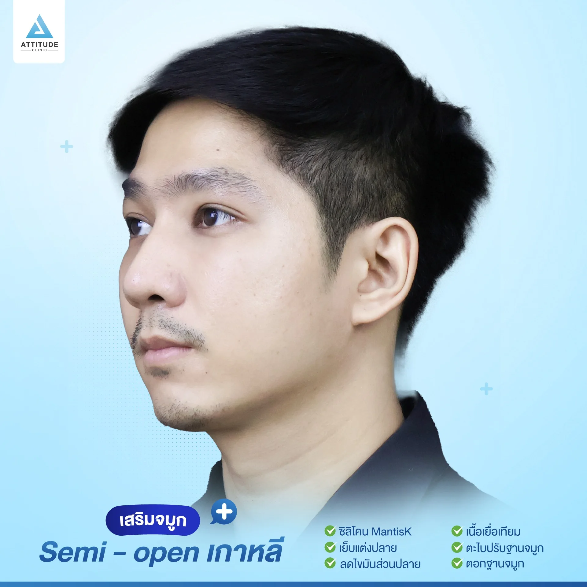 เสริมจมูก