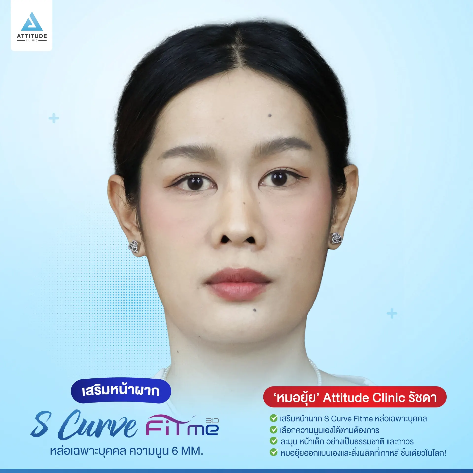 เสริมหน้าผาก