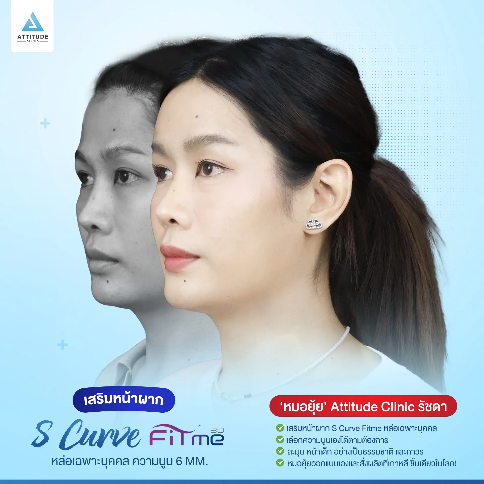 เสริมหน้าผาก