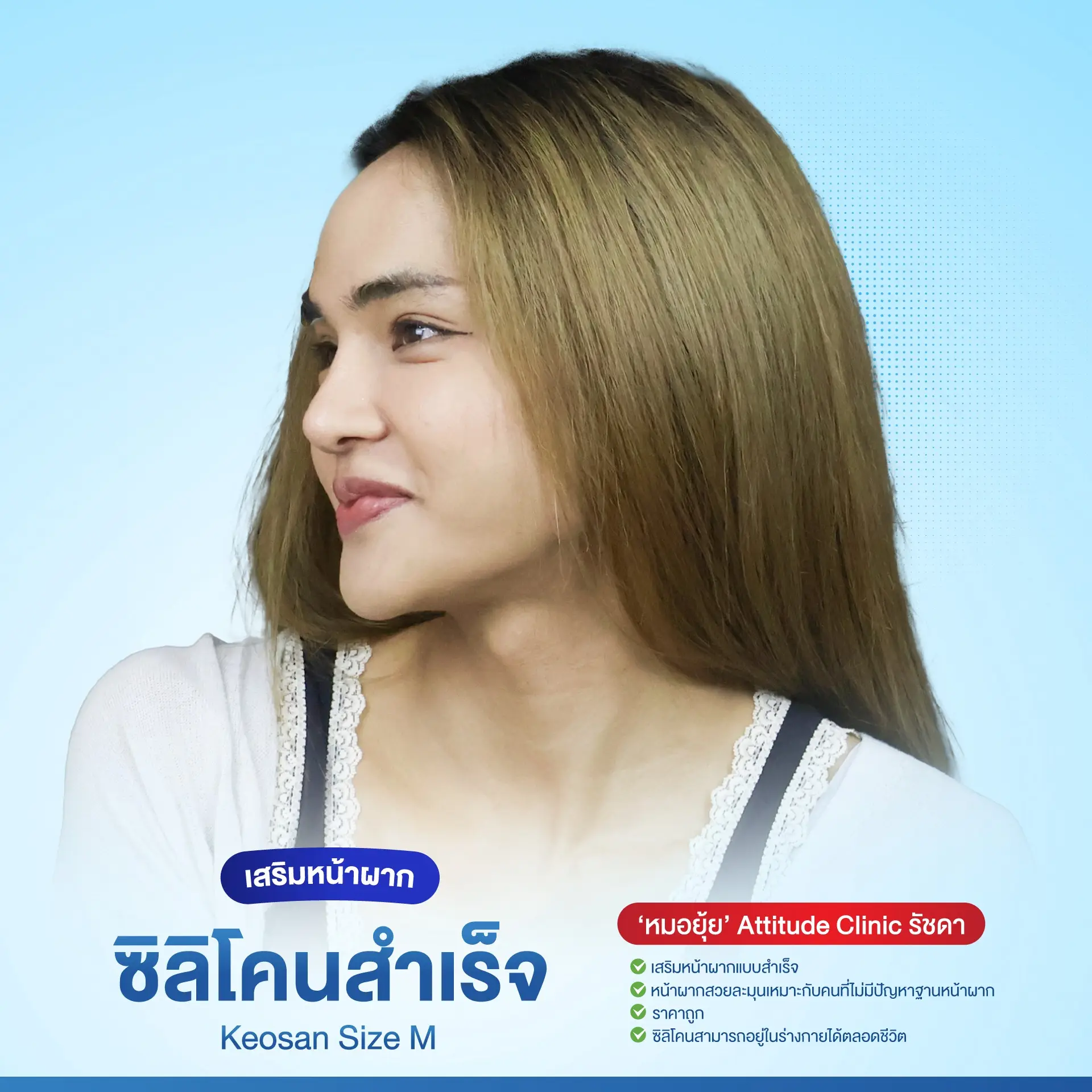 เสริมหน้าผาก