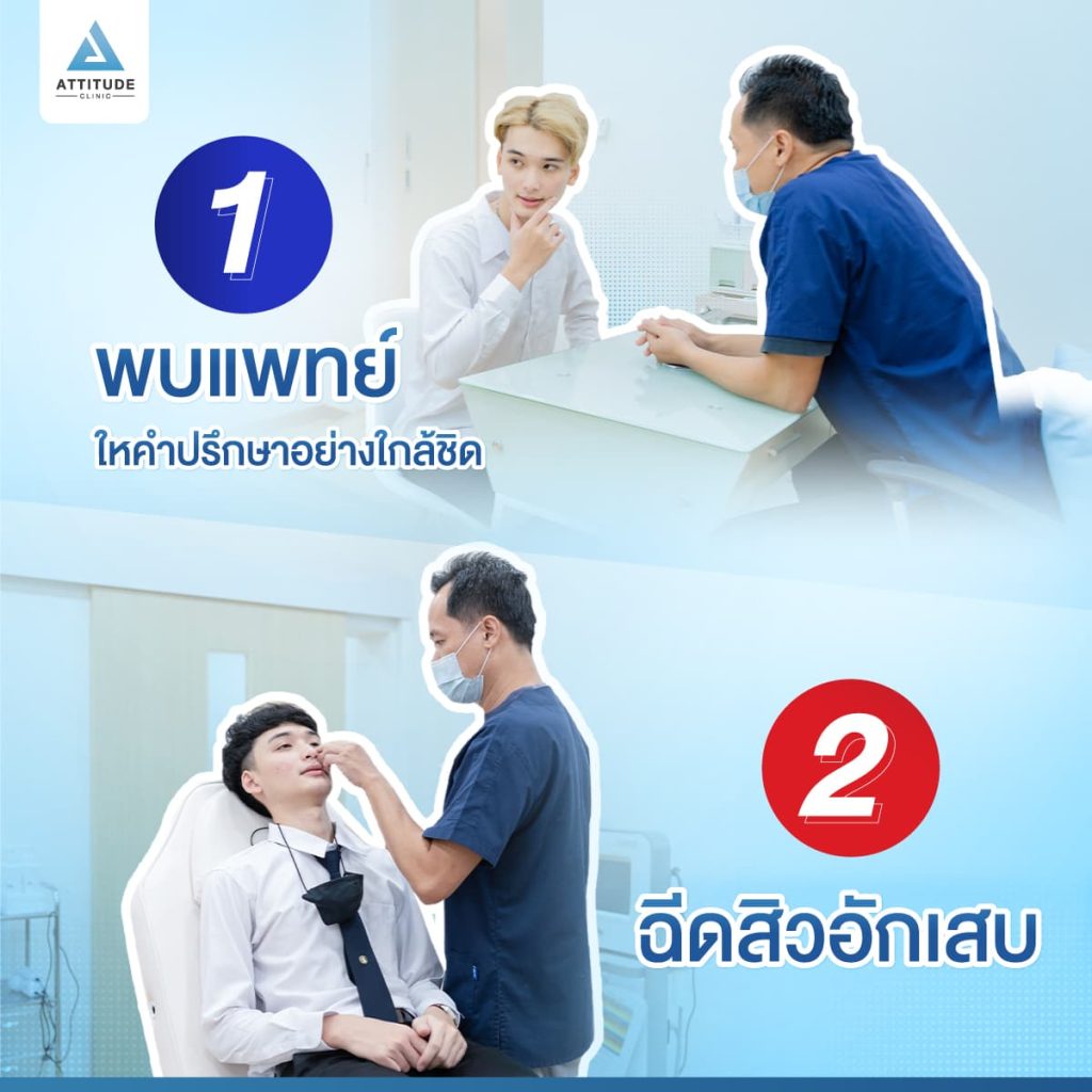 สิวหายจริง จนต้องบอกต่อ ยืนยันกว่าหมื่นเคส Attitude Clinic รักษาสิวครบวงจรจากต้นเหตุสิว ไม่เลี้ยงไข้ ดูแลโดยแพทย์ทุกเคส