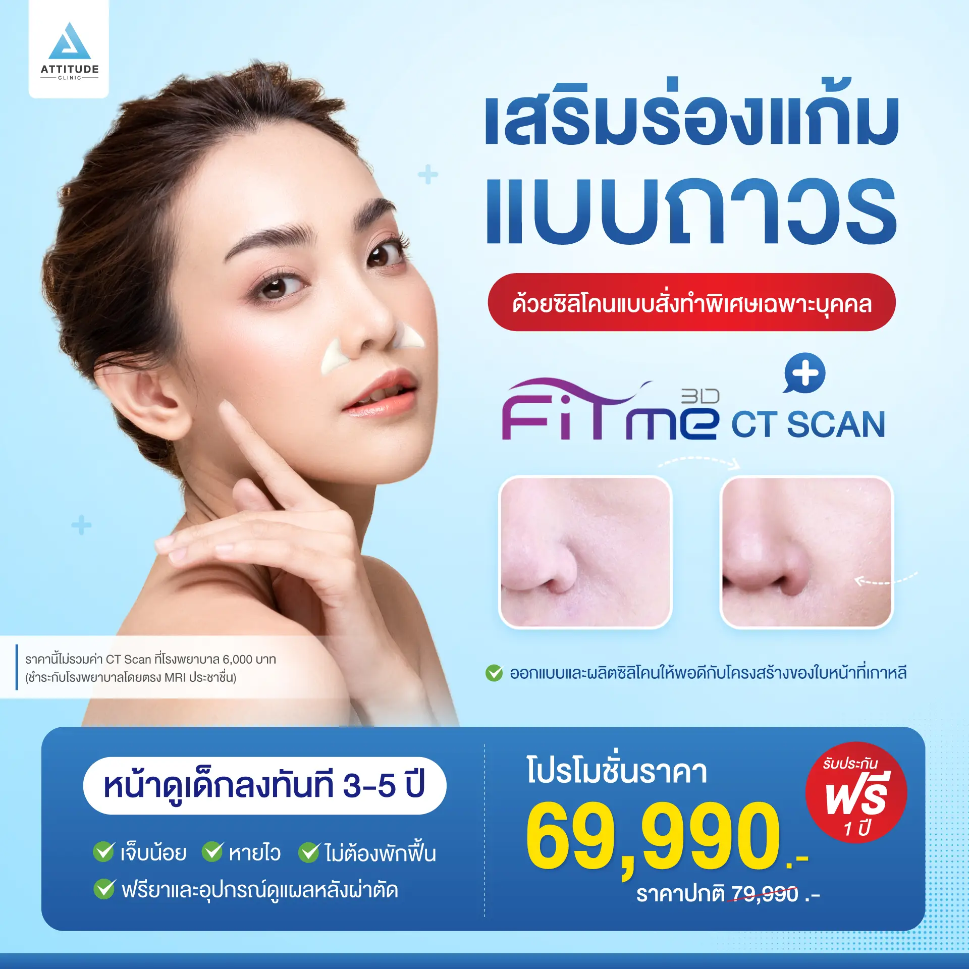 เสริมร่องแก้ม