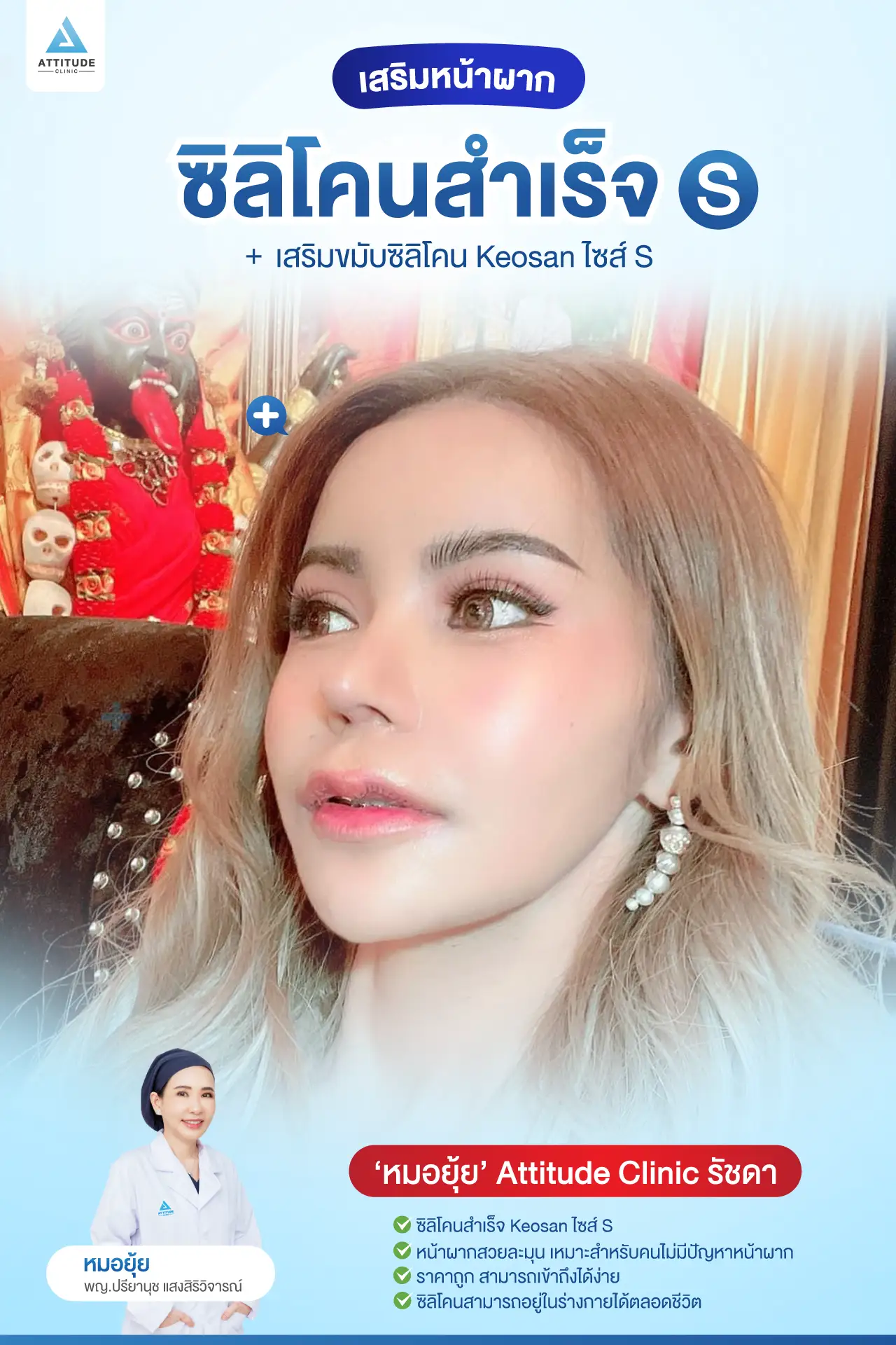 เสริมหน้าผาก
เสริมขมับ