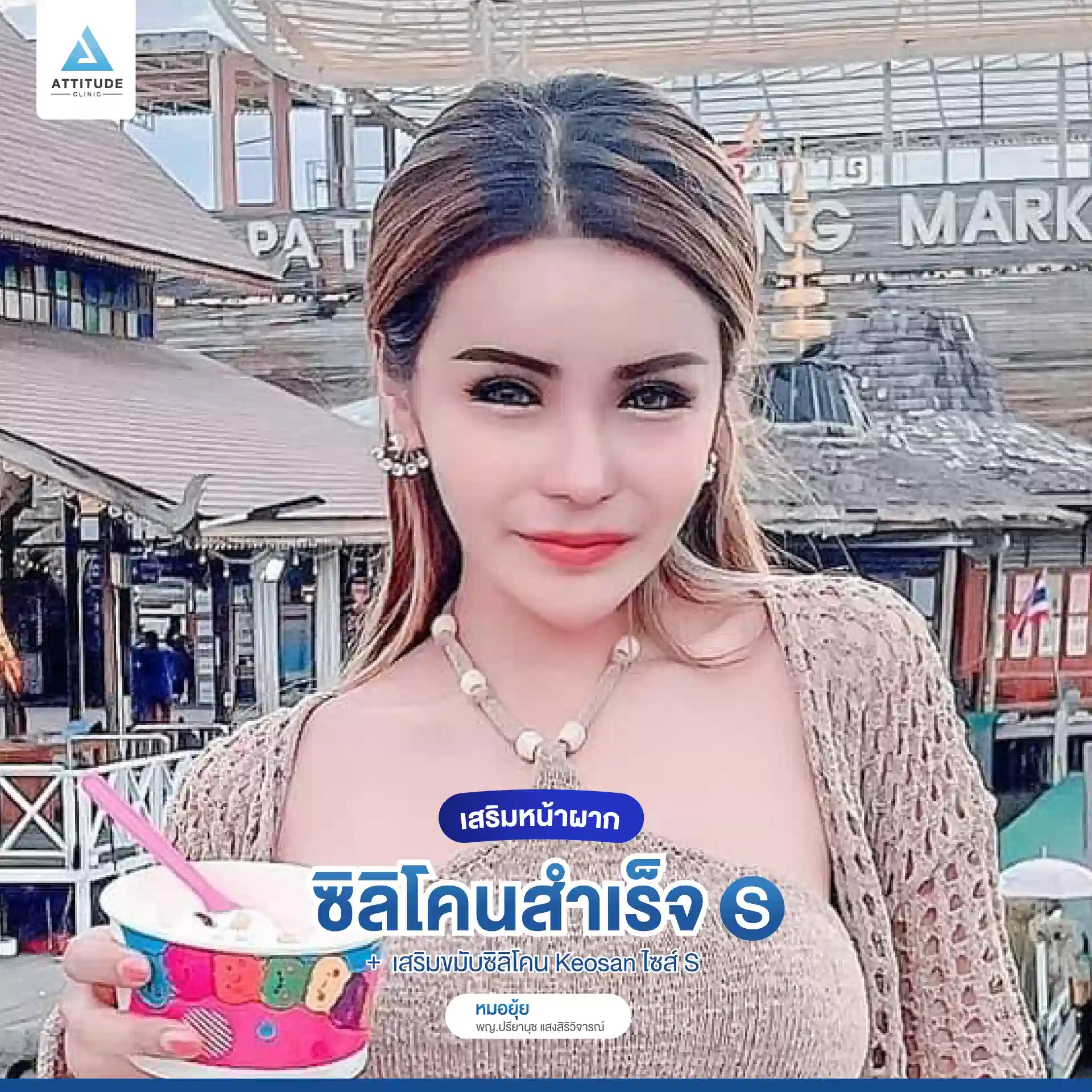 เสริมหน้าผาก
เสริมขมับ