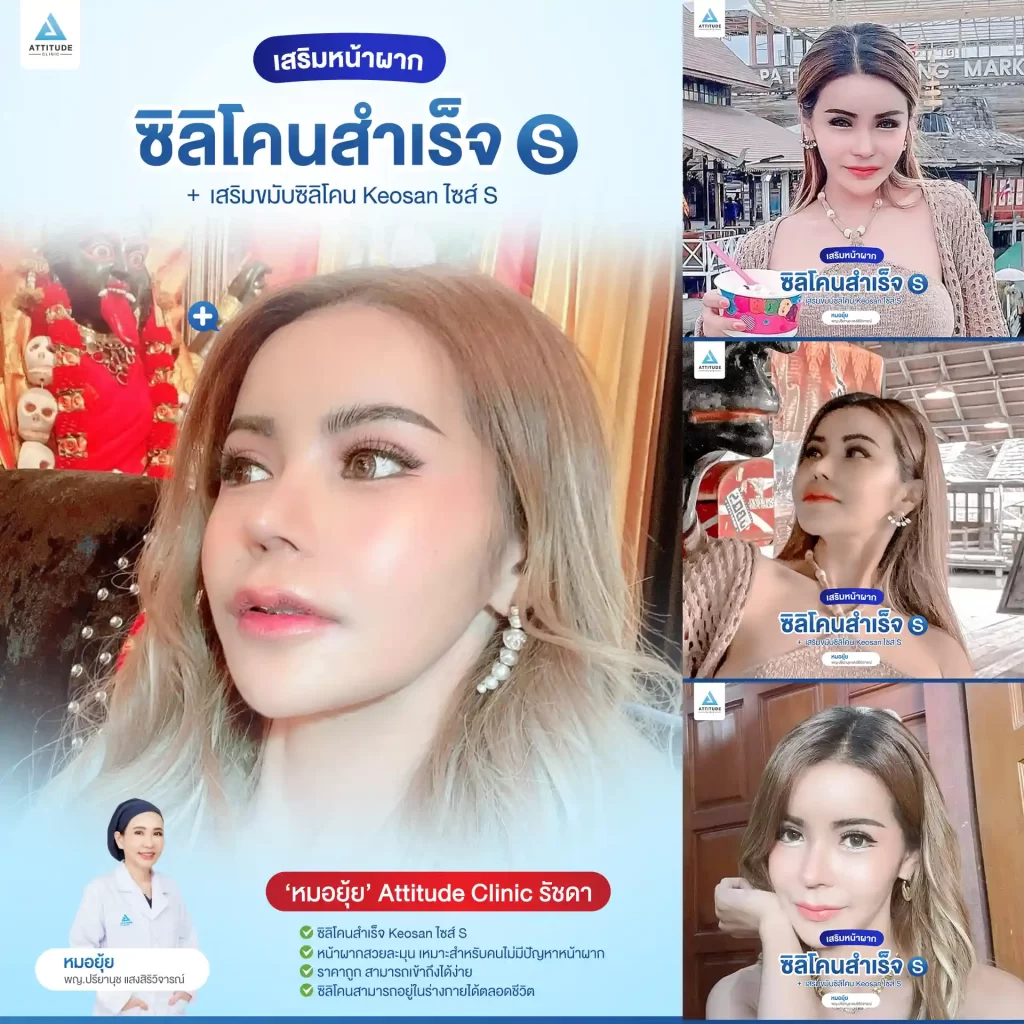เสริมขมับ เสริมหน้าผาก