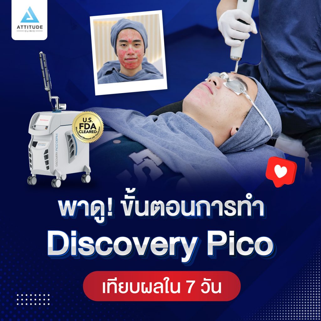 ขั้นตอนการทำ Discovery Pico