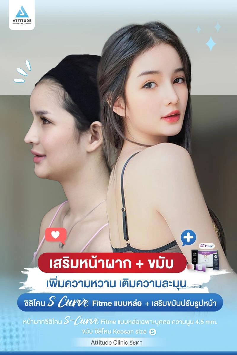 เสริมหน้าผาก เสริมขมับ